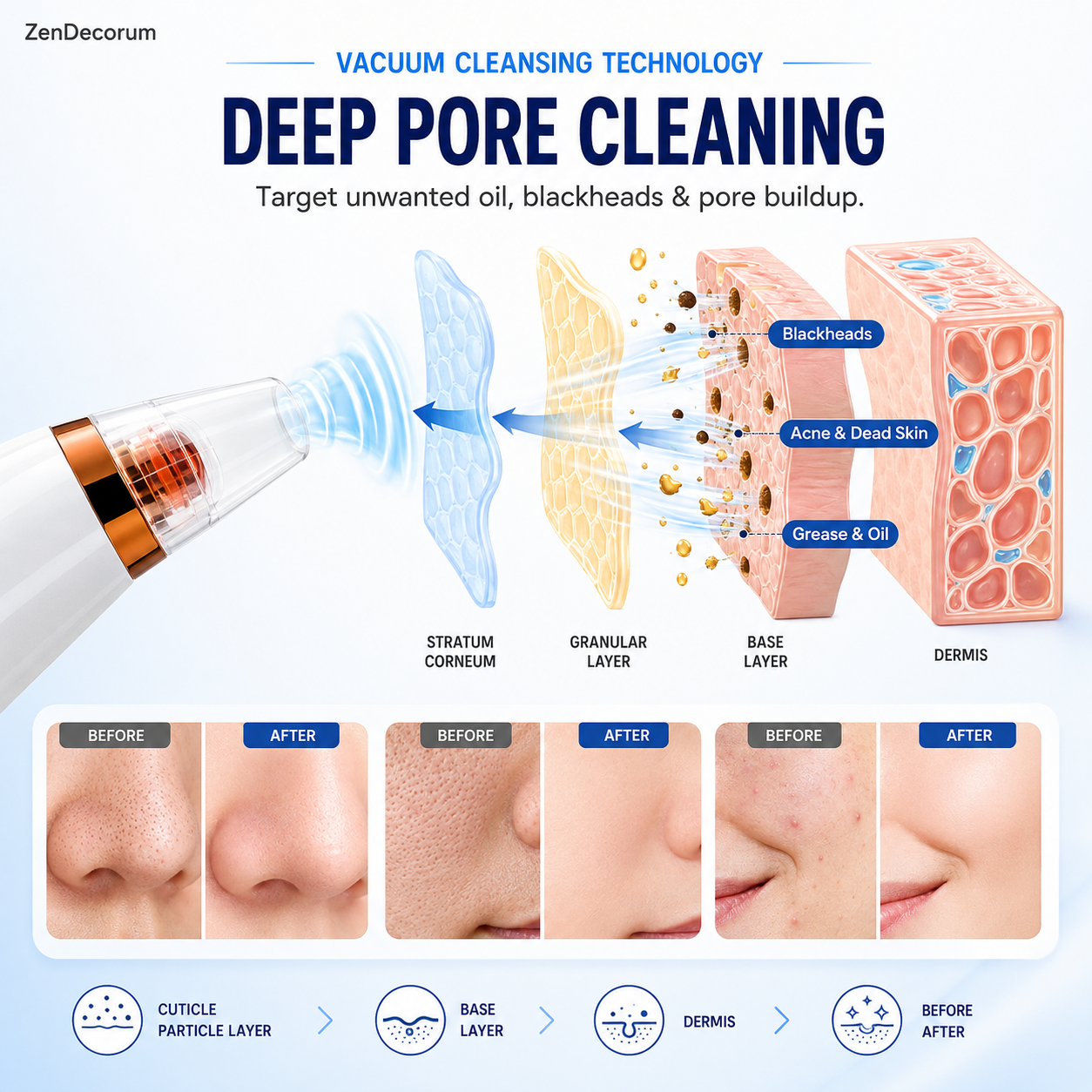 DermaX Pro™ — 6 in 1 Smart Blackhead & Pore Vacuum