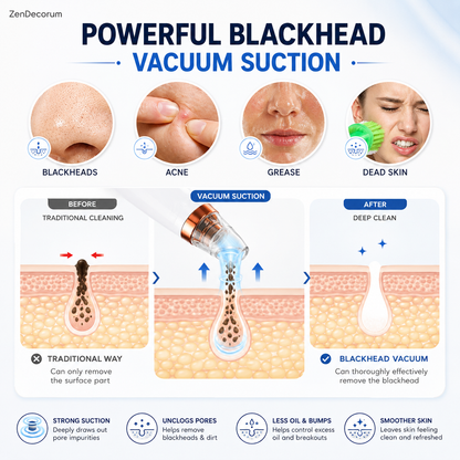DermaX Pro™ — 6 in 1 Smart Blackhead & Pore Vacuum