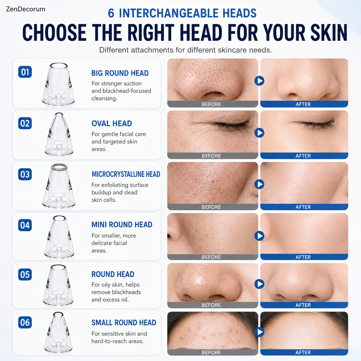 DermaX Pro™ — 6 in 1 Smart Blackhead & Pore Vacuum