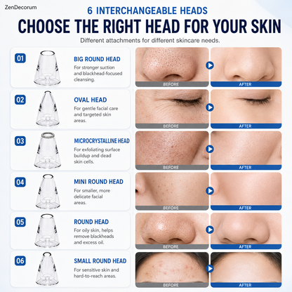 DermaX Pro™ — 6 in 1 Smart Blackhead & Pore Vacuum